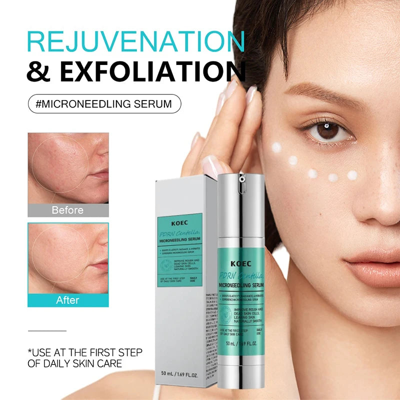 Spicule Microneedling Serum,Pore Exfoliation,Centella Asiatica Propolis Aloe Extract Moisturizing Booster,Korean Glass Skin Care