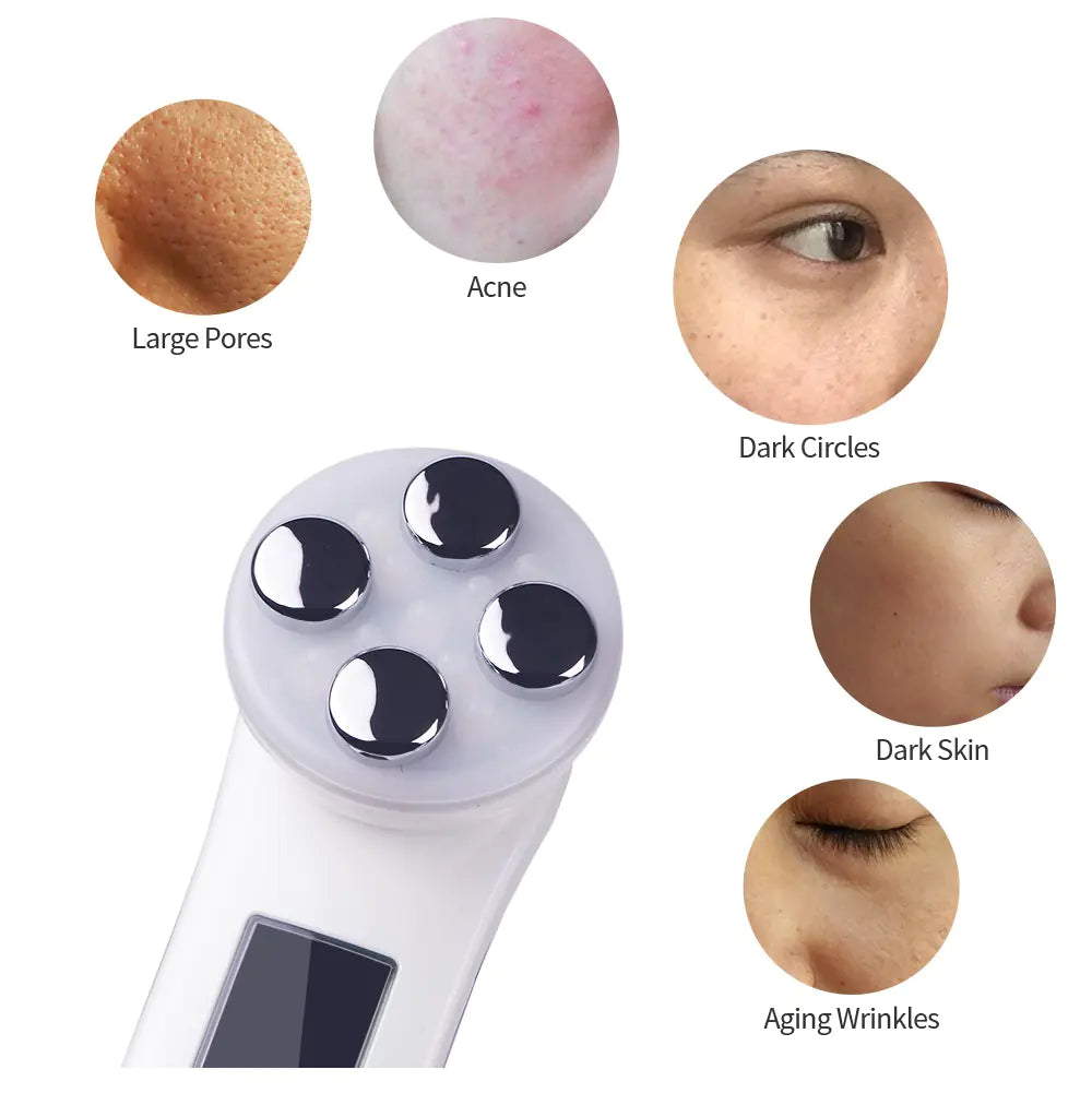 Ems Radio Frequency Beauty Instrument for Skin Care